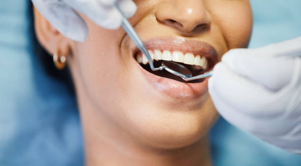 Best Emergency Cosmetic Dentistry in Middleport, NY