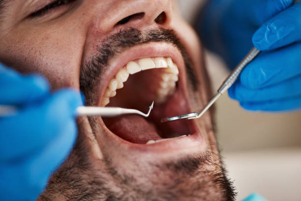 Best Emergency Dentist for Special Needs Patients in Middleport, NY